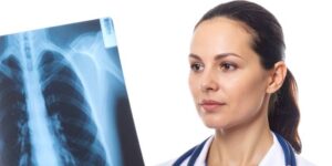 akciger-kanseri-tedavisi