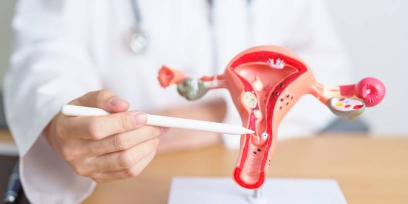 rahim-kanseri-tedavisi